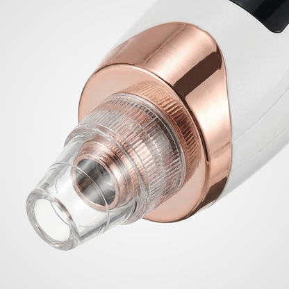 Sona Pore Vacuum