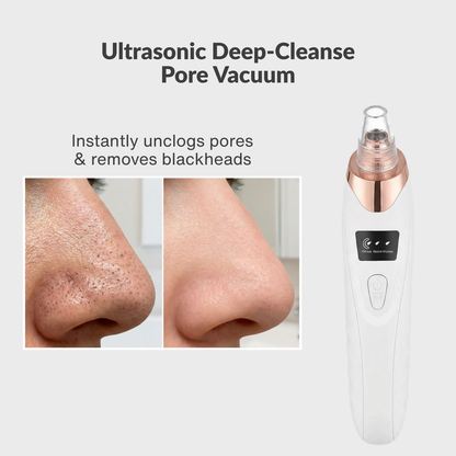 Sona Pore Vacuum