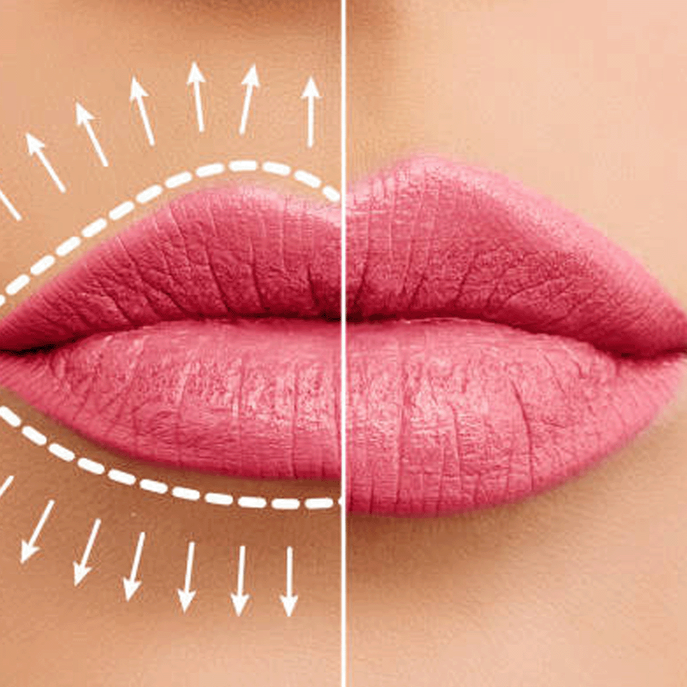 Day & Night Lip Plumper Duo Serum Set